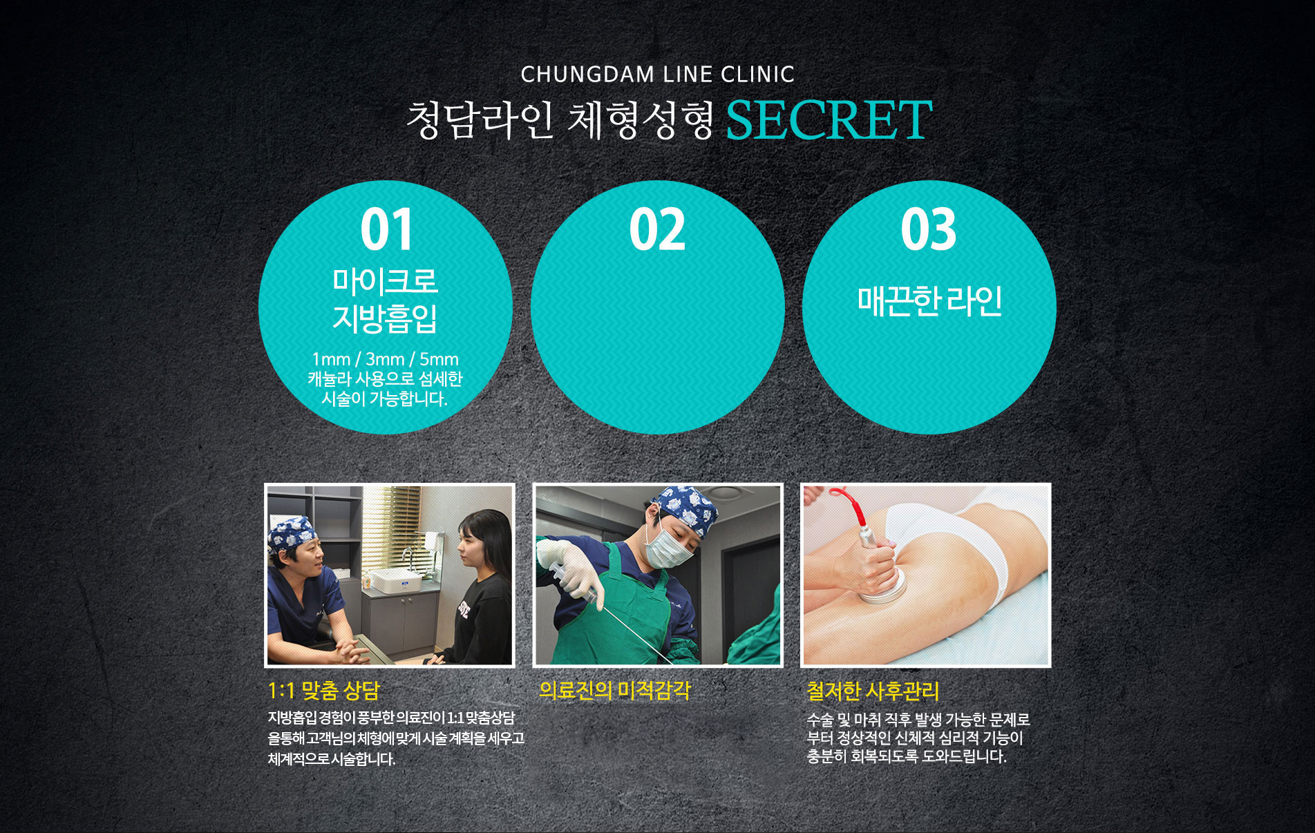 서면청담라인 체형성형 secret?
